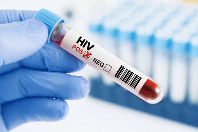 HIV: Prevention, Diagnosis, Treatment